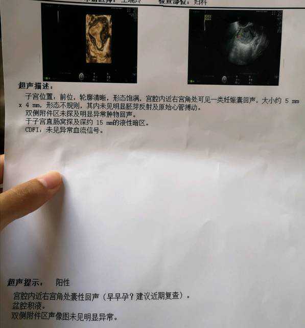 贵州代孕畸形儿，喜报！贵州省首个“第三代试管婴儿”在贵医附院诞生