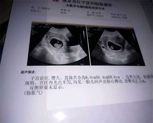 孕前助孕汤：中国如何代孕：可以让孩子更加聪