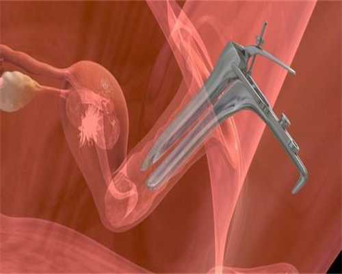 衡州代孕的缺陷：什么是输卵管造影术呢