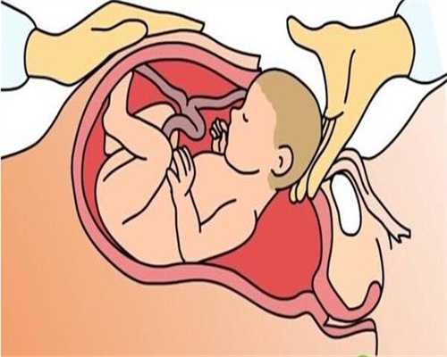 求衡州同居代孕女：卵巢囊腔肿瘤是怎么回事呢