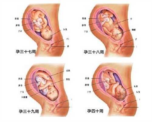 衡州世纪衡州招聘代妈：怎么确诊多囊卵巢综合