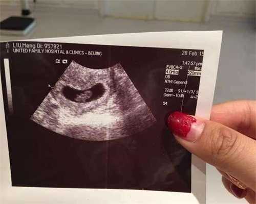 代孕生宝宝：早孕试纸检测是阳性，做B超却看不