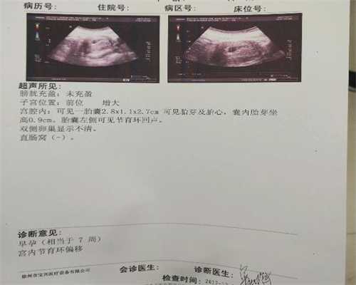 上海合法代孕:如何预防女性卵巢性不孕