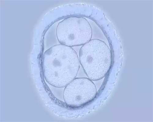 北京代孕网:卵巢癌的预防与最佳治疗方法有哪些