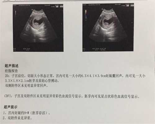 北京代妈捐卵公司，不孕症的治疗必须远离三大