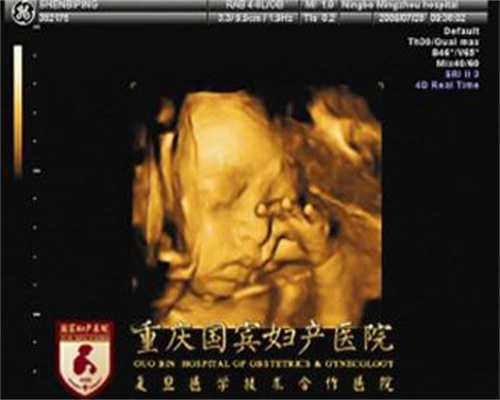 深圳代孕机构:患了卵巢癌在日常要注意什么？