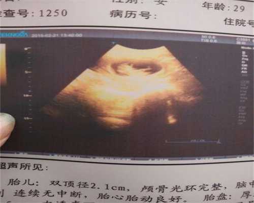最了不起的代孕正规公司_上海市东方医院上海市