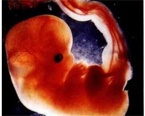 长沙代孕小孩,孕早期代孕妇为何喜欢吃酸代孕妇