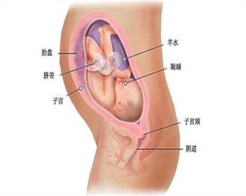 助孕机构_患子宫内膜异位症表现有哪些