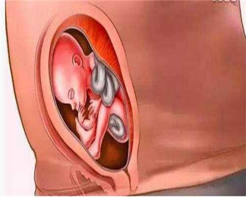 西宁代孕中介,多囊卵巢综合征能吃鹿胎膏吗