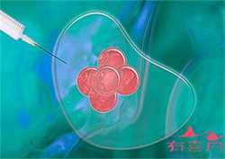 衢州高龄用供卵试管成功率-衢州包成功代生中心，孕妇体检时间表该怎么安排